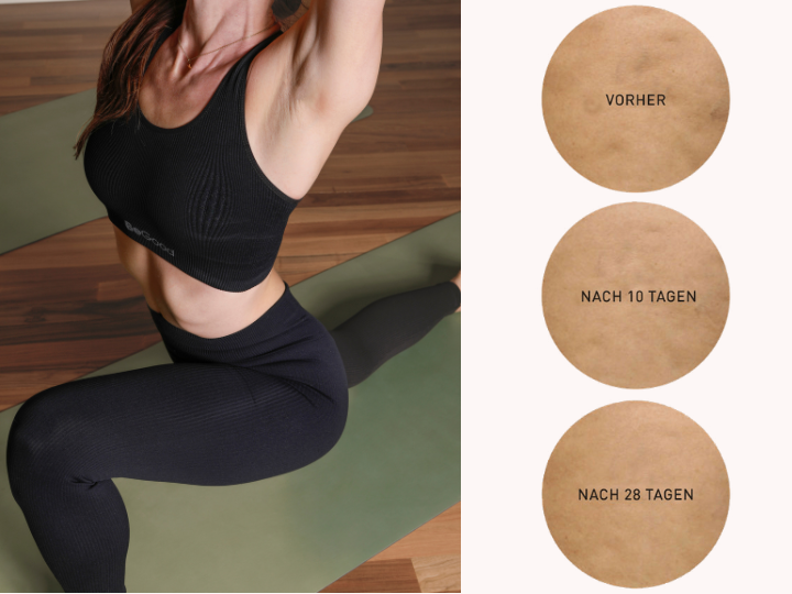 Hautergebnisse nach 28 Tagen konsequenter Anwendung der BeGood Anti-Cellulite-Leggings, mit glatterer, gleichmäßiger und verbesserter Haut.