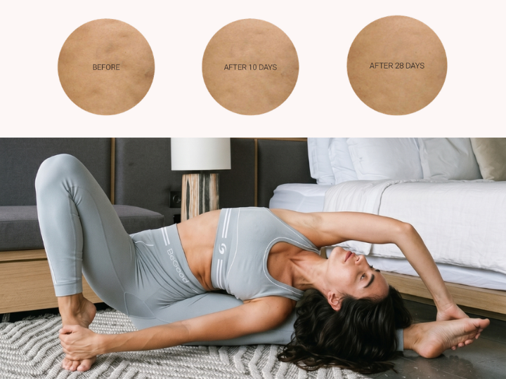 Visible improvement in the appearance of the skin after 28 days of consistent use of BeGood leggings.