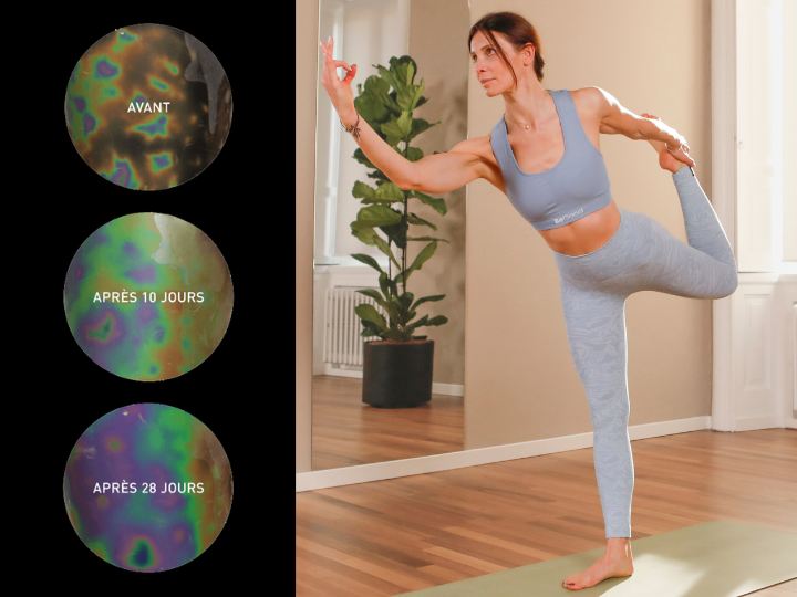 Amélioration de la microcirculation sous‑cutanée après 28 jours d’utilisation constante des leggings BeGood.