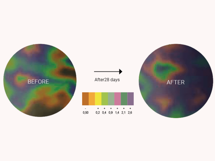 Improved leg microcirculation after 28 days of using BeGood leggings