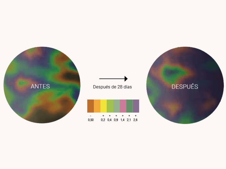 Mejora de la microcirculación de las piernas tras 28 días de uso de los leggings BeGood