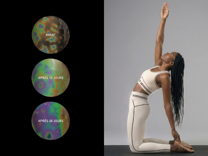 Évolution de la microcirculation sous-cutanée après 28 jours d’utilisation régulière des leggings BeGood