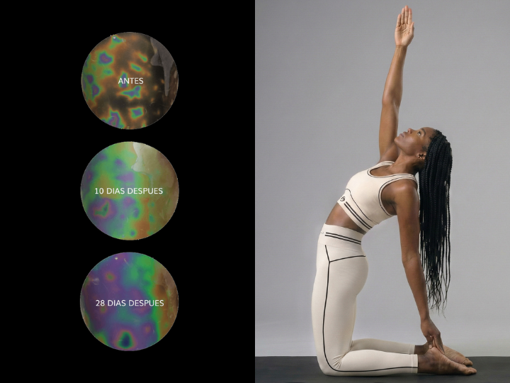 Evolución de la microcirculación subcutánea tras 28 días de uso constante de los leggings BeGood