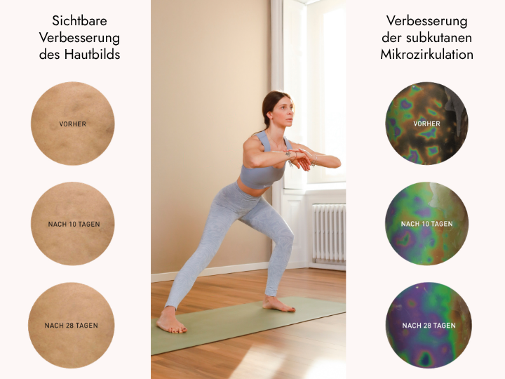 Ergebnisse der figurformenden BeGood Schlankheitsleggings nach regelmäßiger Anwendung: sichtbare Verbesserung des Hautbildes und der Mikrozirkulation nach 10 und 28 Tagen.