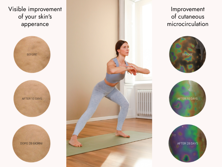 Results of BeGood slimming shaping leggings after consistent use: visible improvement in skin appearance and microcirculation in 10 and 28 days.