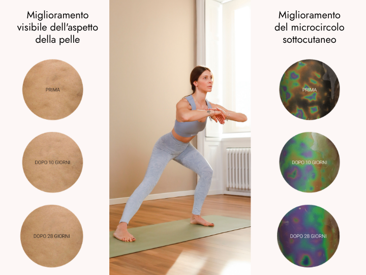 Risultati dei leggings snellenti modellanti BeGood dopo un utilizzo costante: miglioramento visibile dell’aspetto della pelle e del microcircolo in 10 e 28 giorni.