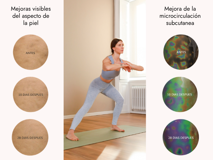 Resultados de los leggings moldeadores adelgazantes BeGood tras un uso constante: mejora visible del aspecto de la piel y de la microcirculación en 10 y 28 días.